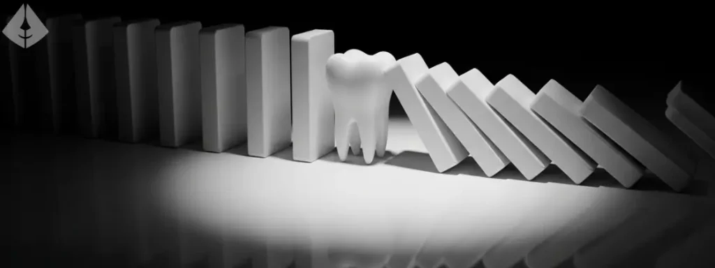 Illustration of the domino effect of missing tooth consequences, showing how one lost tooth affects others