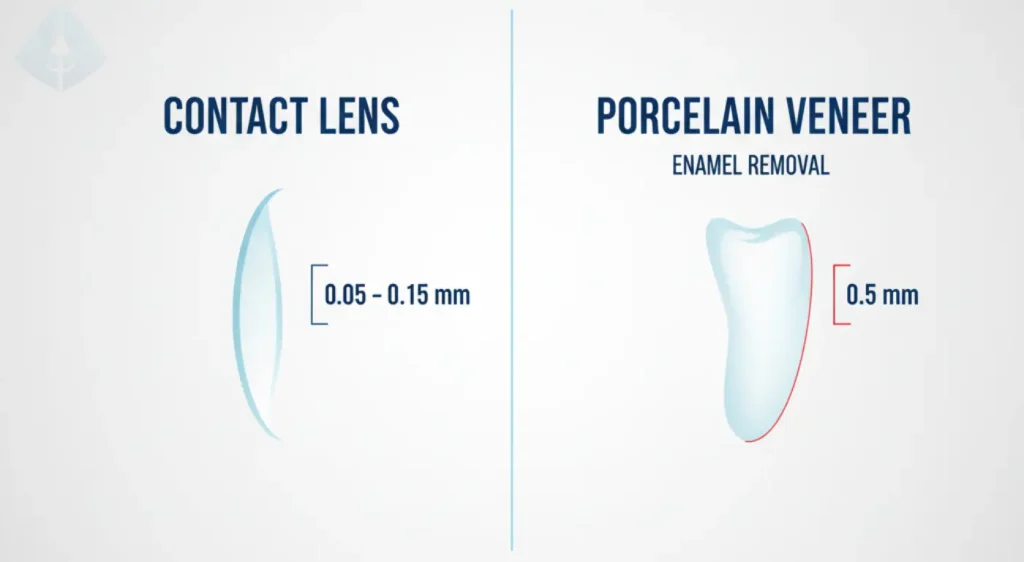 An infographic comparing the minimal 0.5mm of enamel removed for veneers to the thinness of a contact lens.