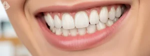 Close up of healthy bright smile illustrating safe teeth under veneers