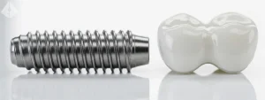 Close up of dental implant components illustrating Dental Implant Cost Westfield quality